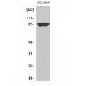 CHML Antibody - Western blot of REP-2 antibody