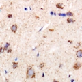 CHMP1B Antibody - Immunohistochemical analysis of CHMP1B staining in rat brain formalin fixed paraffin embedded tissue section. The section was pre-treated using heat mediated antigen retrieval with sodium citrate buffer (pH 6.0). The section was then incubated with the antibody at room temperature and detected using an HRP conjugated compact polymer system. DAB was used as the chromogen. The section was then counterstained with hematoxylin and mounted with DPX.
