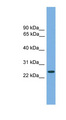 CHMP4B Antibody - CHMP4B antibody Western blot of Jurkat lysate. This image was taken for the unconjugated form of this product. Other forms have not been tested.