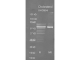 choD Antibody - Goat anti Cholesterol oxidase antibody was used to detect purified cholesterol oxidase under reducing (R) and non-reducing (NR) conditions. Reduced samples of purified cholesterol oxidase contained 4% BME and were boiled for 5 minutes. Samples of ~1ug of protein per lane were run by SDS-PAGE. Protein was transferred to nitrocellulose and probed with a 1:3000 dilution of primary antibody. Detection shown was using Dylight 488 conjugated Donkey anti goat. Images were collected using the BioRad VersaDoc System.