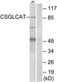 CHPF2 / CSGLCAT Antibody - Western blot analysis of lysates from Jurkat cells, using CSGLCAT Antibody. The lane on the right is blocked with the synthesized peptide.