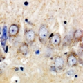 CHPF2 / CSGLCAT Antibody - Immunohistochemical analysis of CSGLCAT staining in human brain formalin fixed paraffin embedded tissue section. The section was pre-treated using heat mediated antigen retrieval with sodium citrate buffer (pH 6.0). The section was then incubated with the antibody at room temperature and detected using an HRP conjugated compact polymer system. DAB was used as the chromogen. The section was then counterstained with haematoxylin and mounted with DPX.