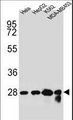 CHPT1 Antibody - CHPT1 Antibody western blot of HeLa,HepG2,K562,MDA-MB453 cell line lysates (35 ug/lane). The CHPT1 antibody detected the CHPT1 protein (arrow).