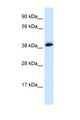CHRNA1 Antibody - CHRNA1 antibody Western blot of Fetal Heart lysate. Antibody concentration 1 ug/ml. This image was taken for the unconjugated form of this product. Other forms have not been tested.