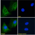 CHRNA1 Antibody - IF staining of HeLa cells.