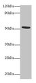 CHRNA1 Antibody - Western blot All lanes: Acetylcholine receptor subunit alpha antibody at 2µg/ml + recombinant Acetylcholine receptor subunit alpha protein 0.1µg Secondary Goat polyclonal to rabbit IgG at 1/15000 dilution Predicted band size: 53 kDa Observed band size: 53 kDa