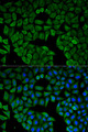 CHRNA1 Antibody - Immunofluorescence analysis of HeLa cells.