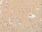 CHRNA2 Antibody - Immunohistochemistry of paraffin-embedded Human brain using CHRNA2 Polyclonal Antibody at dilution of 1:40.