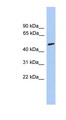 CHRNA5 Antibody - CHRNA5 antibody Western blot of Fetal spleen lysate. This image was taken for the unconjugated form of this product. Other forms have not been tested.