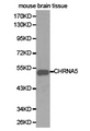 CHRNA5 Antibody - Western blot of extracts of mouse brain tissue cell lines, using CHRNA5 antibody.