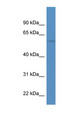 CHRND Antibody - CHRND antibody Western blot of HeLa lysate. This image was taken for the unconjugated form of this product. Other forms have not been tested.