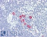 CHST4 / GlcNAc6ST2 Antibody - Anti-GlcNAc6ST2 / CHST4 antibody IHC of human thymus. Immunohistochemistry of formalin-fixed, paraffin-embedded tissue after heat-induced antigen retrieval. Antibody dilution 5-10 ug/ml. This image was taken for the unconjugated form of this product. Other forms have not been tested.