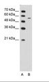 CHST7 Antibody - A: Marker, B: Jurkat Cell Lysate.  This image was taken for the unconjugated form of this product. Other forms have not been tested.