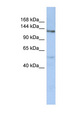 CHSY3 / CSS3 Antibody - CHSY3 antibody Western blot of OVCAR-3 cell lysate. This image was taken for the unconjugated form of this product. Other forms have not been tested.
