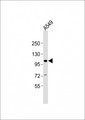 CHSY3 / CSS3 Antibody - Anti-CHSY3 Antibody at 1:2000 dilution + A549 whole cell lysates Lysates/proteins at 20 ug per lane. Secondary Goat Anti-Rabbit IgG, (H+L), Peroxidase conjugated at 1/10000 dilution Predicted band size : 100 kDa Blocking/Dilution buffer: 5% NFDM/TBST.