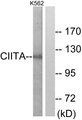 CIITA Antibody - Western blot analysis of lysates from K562 cells, using CIITA Antibody. The lane on the right is blocked with the synthesized peptide.