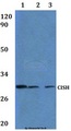 CISH / SOCS Antibody - Western blot of CISH antibody at 1:500 dilution. Lane 1: HELA whole cell lysate. Lane 2: RAW264.7 whole cell lysate.