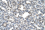 CIZ1 Antibody - CIZ1 antibody ARP38956_P050-NP_036259-CIZ1(CDKN1A interacting zinc finger protein 1) Antibody IHC of formalin-fixed, paraffin-embedded human Lung. Positive label: Alveolar cells indicated with arrows. Antibody concentration 4-8 ug/ml. Magnification 400X.  This image was taken for the unconjugated form of this product. Other forms have not been tested.