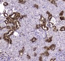 CKB / Creatine Kinase BB Antibody - Immunohistochemistry - Anti-CKB Picoband antibody