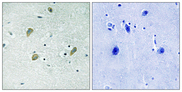 CKI-Gamma 1+2+3 Antibody - Immunohistochemistry of paraffin-embedded human brain tissue using CK-1 gamma 1/2/3 antibody.