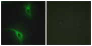 CKS1B / CKS1 Antibody - Immunofluorescence analysis of HeLa cells, using CKS1 Antibody. The picture on the right is blocked with the synthesized peptide.