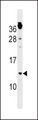 CKS1B / CKS1 Antibody - CKS1B Antibody western blot of NCI-H292 cell line lysates (35 ug/lane). The CKS1B antibody detected the CKS1B protein (arrow).