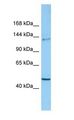 CLASP2 Antibody - CLASP2 antibody Western Blot of ACHN.  This image was taken for the unconjugated form of this product. Other forms have not been tested.