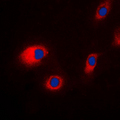 CLC-7 / CLCN7 Antibody - Immunofluorescent analysis of CLCN7 staining in HeLa cells. Formalin-fixed cells were permeabilized with 0.1% Triton X-100 in TBS for 5-10 minutes and blocked with 3% BSA-PBS for 30 minutes at room temperature. Cells were probed with the primary antibody in 3% BSA-PBS and incubated overnight at 4 C in a humidified chamber. Cells were washed with PBST and incubated with a DyLight 594-conjugated secondary antibody (red) in PBS at room temperature in the dark. DAPI was used to stain the cell nuclei (blue).