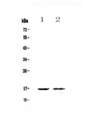 CLC Antibody - Western blot - Anti-Galectin 10 Picoband antibody
