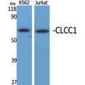 CLCC1 Antibody - Western blot of CLCC1 antibody