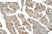 CLCC1 Antibody - CLCC1 antibody ARP44970_T100-NP_001041675-CLCC1(chloride channel CLIC-like 1) Antibody IHC of formalin-fixed, paraffin-embedded human Muscle. Positive label: Skeletal muscle cells indicated with arrows. Antibody concentration 4-8 ug/ml. Magnification 400X.  This image was taken for the unconjugated form of this product. Other forms have not been tested.