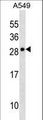CLCF1 Antibody - CLCF1 Antibody western blot of A549 cell line lysates (35 ug/lane). The CLCF1 antibody detected the CLCF1 protein (arrow).