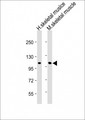 CLCN1 / CLC-1 Antibody - All lanes: Anti-CLCN1 Antibody (N-Term) at 1:2000 dilution Lane 1: Human skeletal muslce lysate Lane 2: Mouse skeletal muscle lysate Lysates/proteins at 20 µg per lane. Secondary Goat Anti-Rabbit IgG, (H+L), Peroxidase conjugated at 1/10000 dilution. Predicted band size: 109 kDa Blocking/Dilution buffer: 5% NFDM/TBST.