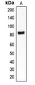 CLCN4 / CLC-4 Antibody - Western blot analysis of CLCN4 expression in MDAMB453 (A) whole cell lysates.