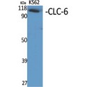 CLCN6 Antibody - Western blot of CLC-6 antibody
