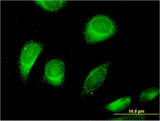 CLCN6 Antibody - Immunofluorescence of monoclonal antibody to CLCN6 on HeLa cell . [antibody concentration 10 ug/ml]