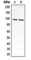 CLCN6 Antibody - Western blot analysis of CLCN6 expression in HEK293A (A); Jurkat (B) whole cell lysates.
