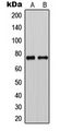 CLCNKA Antibody - Western blot analysis of CLCNKA expression in HeLa (A); rat liver (B) whole cell lysates.