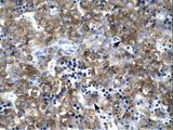 CLDN1 / Claudin 1 Antibody - CLDN1 / Claudin 1 antibody ARP33623_P050-NP_066924-CLDN1 (claudin 1) Antibody was used in IHC to stain formalin-fixed, paraffin-embedded human liver.  This image was taken for the unconjugated form of this product. Other forms have not been tested.