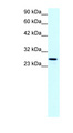 Cldn13 / Claudin 13 Antibody - CLDN13 antibody ARP33616_T100-NP_065250-CLDN13 Antibody Western blot of Jurkat lysate.  This image was taken for the unconjugated form of this product. Other forms have not been tested.