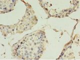 CLDN15 / Claudin 15 Antibody - Immunohistochemistry of paraffin-embedded human testis tissue using antibody at 1:100 dilution.  This image was taken for the unconjugated form of this product. Other forms have not been tested.