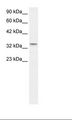 CLDN16 / Claudin 16 Antibody - Fetal Lung Lysate.  This image was taken for the unconjugated form of this product. Other forms have not been tested.