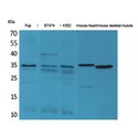 CLDN17 / Claudin 17 Antibody - Western blot of Claudin-17 antibody