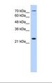 CLDN2 / Claudin 2 Antibody - HepG2 cell lysate. Antibody concentration: 1.25 ug/ml. Gel concentration: 12%.  This image was taken for the unconjugated form of this product. Other forms have not been tested.