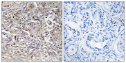 CLDN6 / Claudin 6 Antibody - Immunohistochemistry analysis of paraffin-embedded human ovary tissue, using CLDN6 Antibody. The picture on the right is blocked with the synthesized peptide.