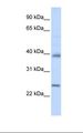 CLDN7 / Claudin 7 Antibody - Hela cell lysate. Antibody concentration: 1.0 ug/ml. Gel concentration: 12%.  This image was taken for the unconjugated form of this product. Other forms have not been tested.