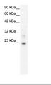 CLDN9 / Claudin 9 Antibody - HepG2 Cell Lysate.  This image was taken for the unconjugated form of this product. Other forms have not been tested.