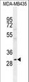 CLEC10A / CD301 Antibody - CLEC10A Antibody western blot of MDA-MB435 cell line lysates (35 ug/lane). The CLEC10A antibody detected the CLEC10A protein (arrow).