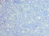 CLEC12A / CD371 Antibody - Immunohistochemistry of paraffin-embedded human tonsil using antibody at 1:100 dilution.