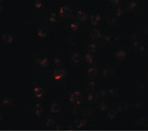 CLEC2A Antibody - Immunofluorescence of CLEC2A in K562 cells with CLEC2A antibody at 20 ug/ml.
